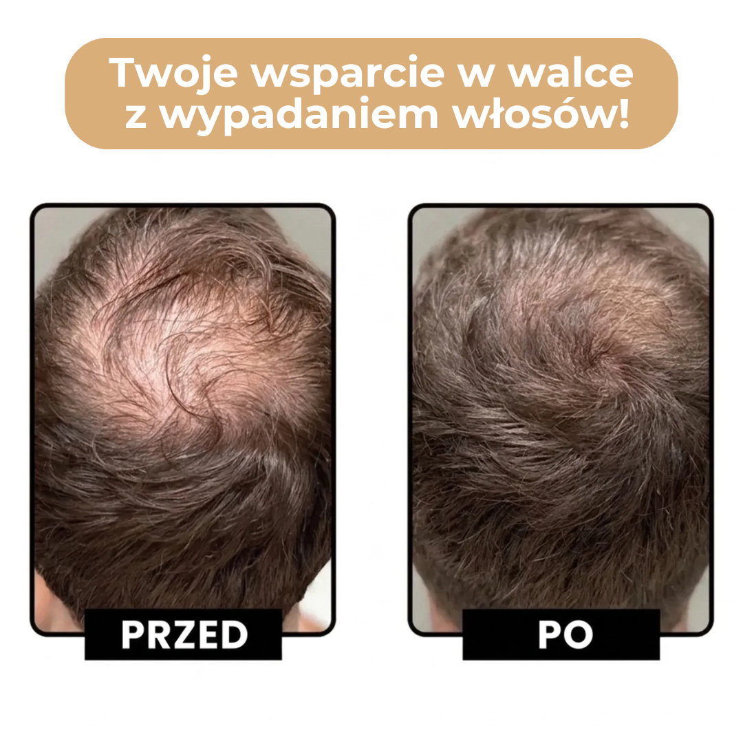 DARKIN - Puder zagęszczający włosy